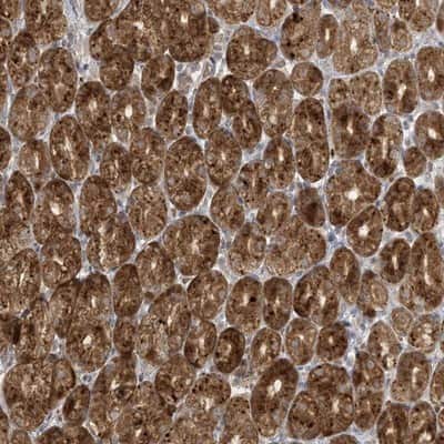Immunohistochemistry-Paraffin: DULLARD Antibody [NBP1-87961]