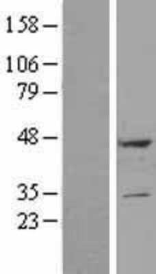 Western Blot: DULLARD Overexpression Lysate [NBP2-11067]