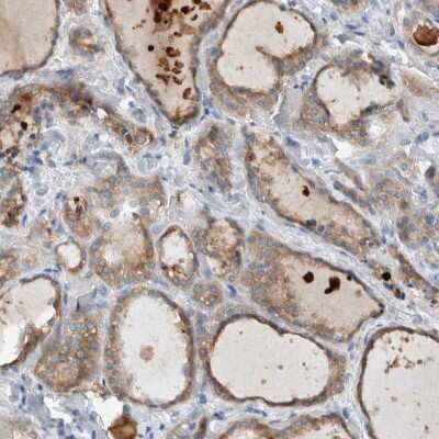 Immunohistochemistry-Paraffin: DUOX1 Antibody [NBP1-81301]