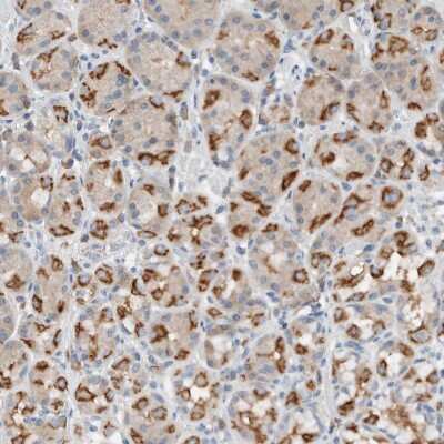 Immunohistochemistry-Paraffin: DUOX1 Antibody [NBP1-81301]
