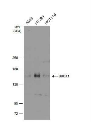 Western Blot: DUOX1 Antibody [NBP2-16232]