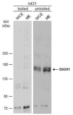 Western Blot: DUOX1 Antibody [NBP2-16232]