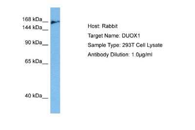 Western Blot: DUOX1 Antibody [NBP2-87306]