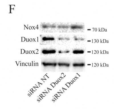 Knockdown Validated: DUOX2 Antibody - BSA Free [NB110-61576]