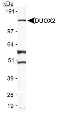Western Blot: DUOX2 AntibodyBSA Free [NB110-61576]