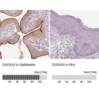 Immunohistochemistry-Paraffin: DUOXA2 Antibody [NBP2-57547]