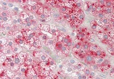 Immunohistochemistry-Paraffin: DUOXA2 Antibody [NBP2-82936]