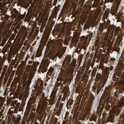 Immunohistochemistry-Paraffin: DUS1L Antibody [NBP1-84962]