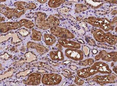 Immunohistochemistry-Paraffin: DUS1L Antibody [NBP3-06506]