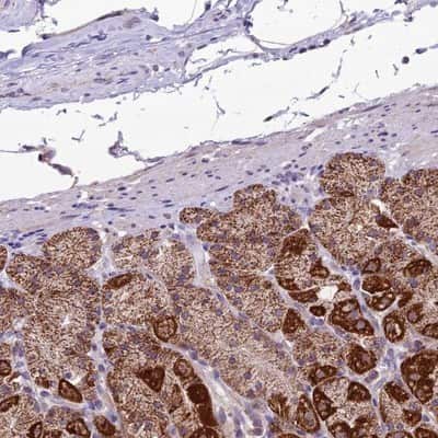 Immunohistochemistry-Paraffin: DUS2L Antibody [NBP1-91852]