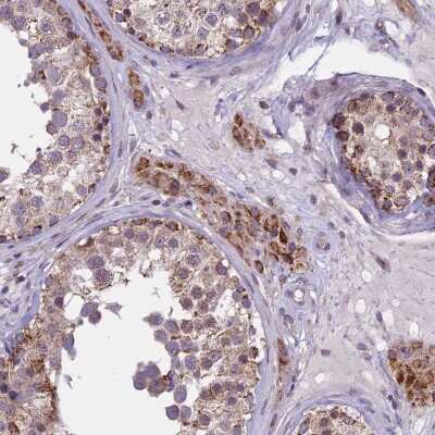 Immunohistochemistry-Paraffin: DUS2L Antibody [NBP1-91852]