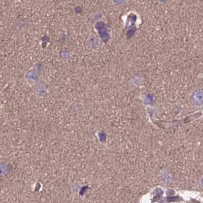 Immunohistochemistry-Paraffin: DUS2L Antibody [NBP1-91852]