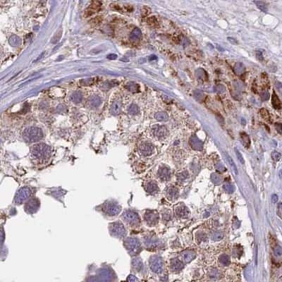 Immunohistochemistry-Paraffin: DUS2L Antibody [NBP1-91852]