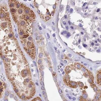Immunohistochemistry-Paraffin: DUS2L Antibody [NBP1-91852]