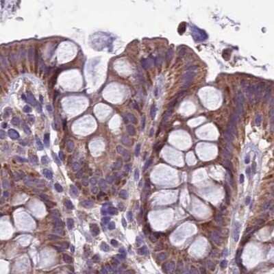 Immunohistochemistry-Paraffin: DUS2L Antibody [NBP1-91852]