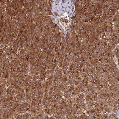 Immunohistochemistry-Paraffin: DUS2L Antibody [NBP1-91853]