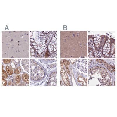 Immunohistochemistry-Paraffin: DUS2L Antibody [NBP1-91853]
