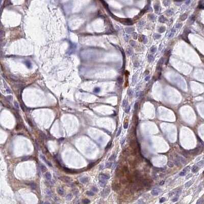 Immunohistochemistry-Paraffin: DUS2L Antibody [NBP1-91853]