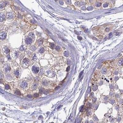 Immunohistochemistry-Paraffin: DUS2L Antibody [NBP1-91853]