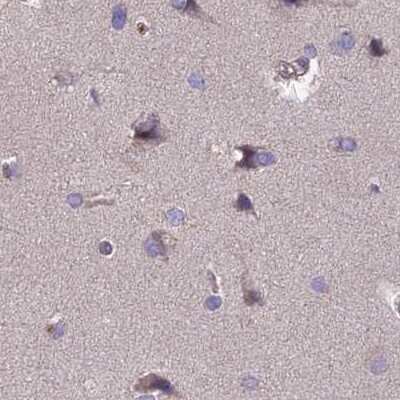 Immunohistochemistry-Paraffin: DUS2L Antibody [NBP1-91853]