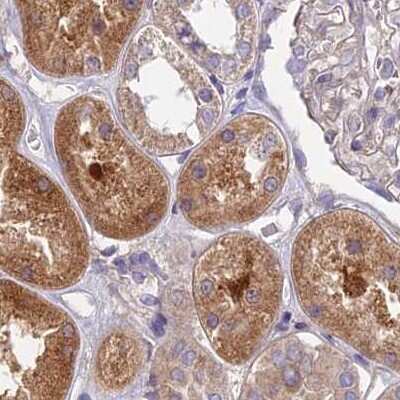 Immunohistochemistry-Paraffin: DUS2L Antibody [NBP1-91853]