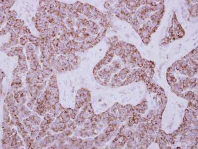 Immunohistochemistry-Paraffin: DUS2L Antibody [NBP2-16234]