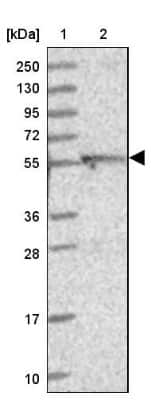 Western Blot: DUS2L Antibody [NBP1-91852]