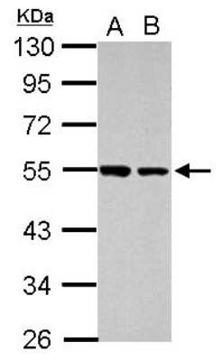 Western Blot: DUS2L Antibody [NBP2-16233]