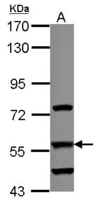 Western Blot: DUS2L Antibody [NBP2-16234]