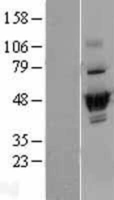 Western Blot: DUS2L Overexpression Lysate [NBP2-04364]