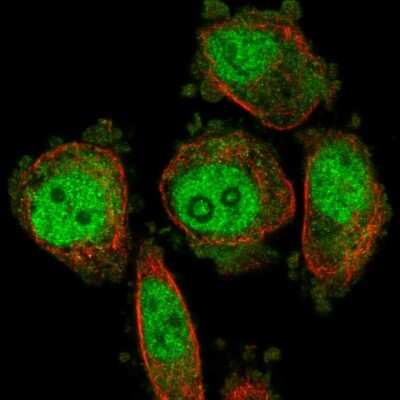 Immunocytochemistry/ Immunofluorescence: DUS3L Antibody [NBP2-56853]