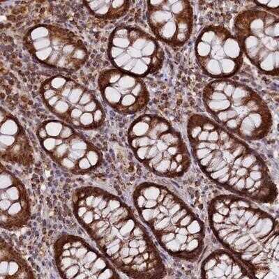 Immunohistochemistry-Paraffin: DUS3L Antibody [NBP1-84043]