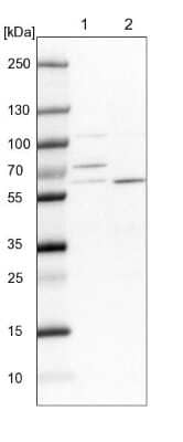 Western Blot: DUS3L Antibody [NBP1-84042]