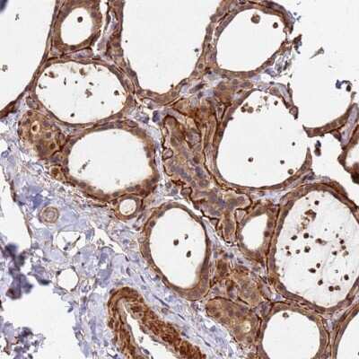 Immunohistochemistry-Paraffin: DUS4L Antibody [NBP1-91854]