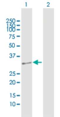 Western Blot: DUS4L Antibody [H00011062-D01P]