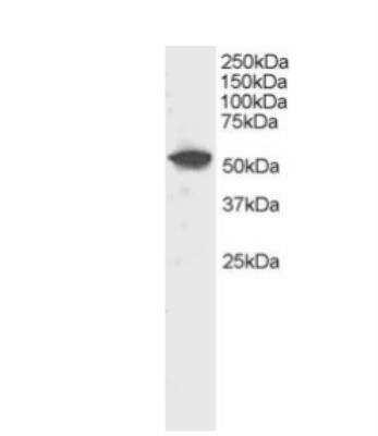 Western Blot: DUSP10 Antibody [NB100-888]