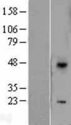 Western Blot: DUSP10 Overexpression Lysate [NBL1-10045]