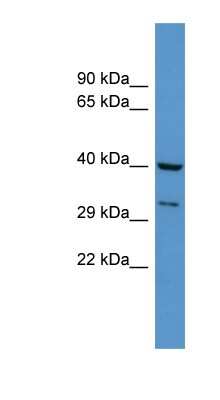 Western Blot: DUSP11 Antibody [NBP1-68919]