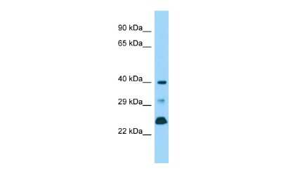 Western Blot: DUSP11 Antibody [NBP2-87311]