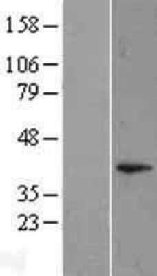 Western Blot: DUSP11 Overexpression Lysate [NBL1-10047]