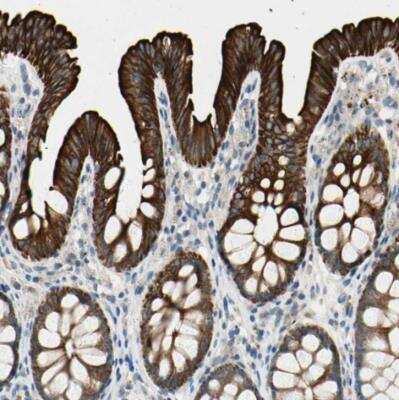 Immunohistochemistry-Paraffin: DUSP12 Antibody [NBP1-84961]