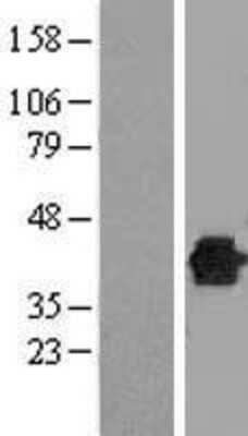 Western Blot: DUSP12 Overexpression Lysate [NBL1-10048]