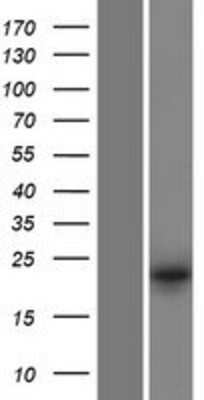 Western Blot: DUSP13 Overexpression Lysate [NBP2-07039]