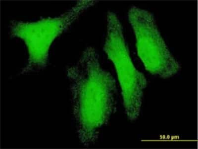 Immunocytochemistry/ Immunofluorescence: DUSP14 Antibody (4B5-E6) [H00011072-M02]