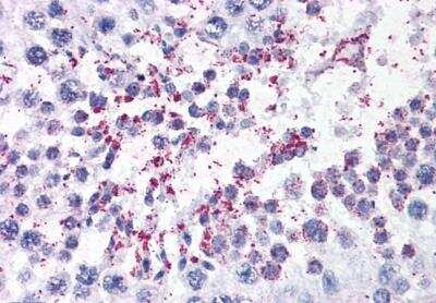 Immunohistochemistry-Paraffin: DUSP14 Antibody [NB100-887]