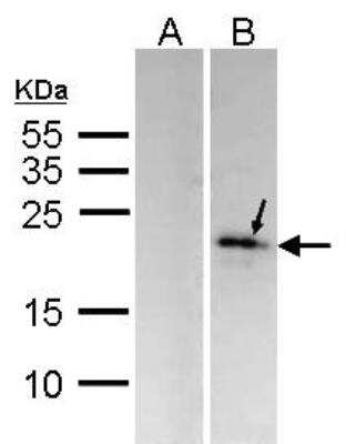 Western Blot: DUSP14 Antibody [NBP2-16237]