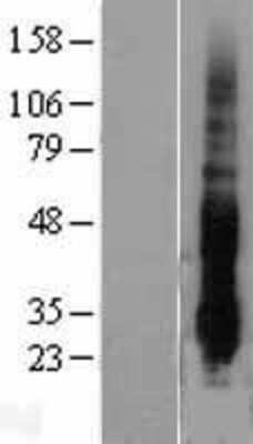 Western Blot: DUSP14 Overexpression Lysate [NBL1-10049]