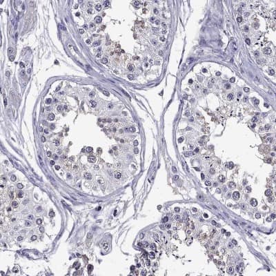 Immunohistochemistry-Paraffin: DUSP15 Antibody [NBP2-57320]