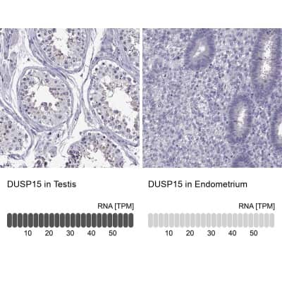Immunohistochemistry-Paraffin: DUSP15 Antibody [NBP2-57320]