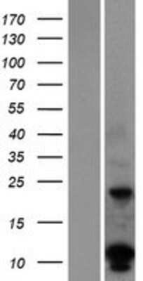 Western Blot: DUSP15 Overexpression Lysate [NBP2-04954]